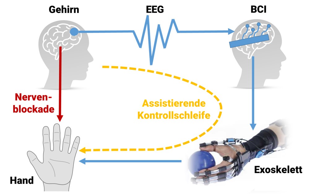 Exoskeletts: Wiederherstellung des Nervensystems der Hand