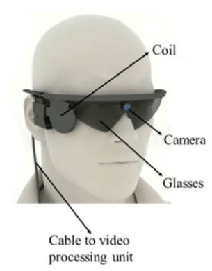 Epiretinales Implantat